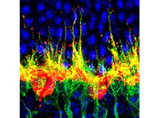 In normal aged retina, rod bipolar cells and horizontal cells remodel aberrantly, sending long processes into outer retina.