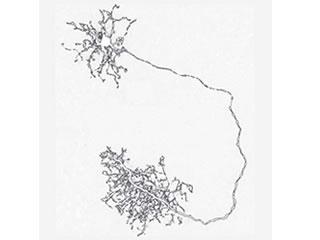 Single mouse horizontal cell neuron visualized using AAV.