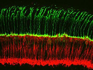 The first steps of vision occur when photoreceptors (green) detect light and relay those signals to bipolar neurons (red).