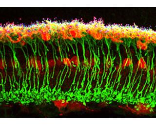 retina-lamination-sm